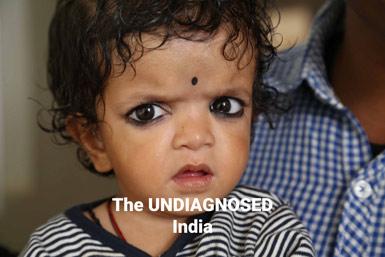 Ett litet barn med mörkt lockigt hår och bindi i pannan tittar mot kameran, med texten The UNDIAGNOSED India.